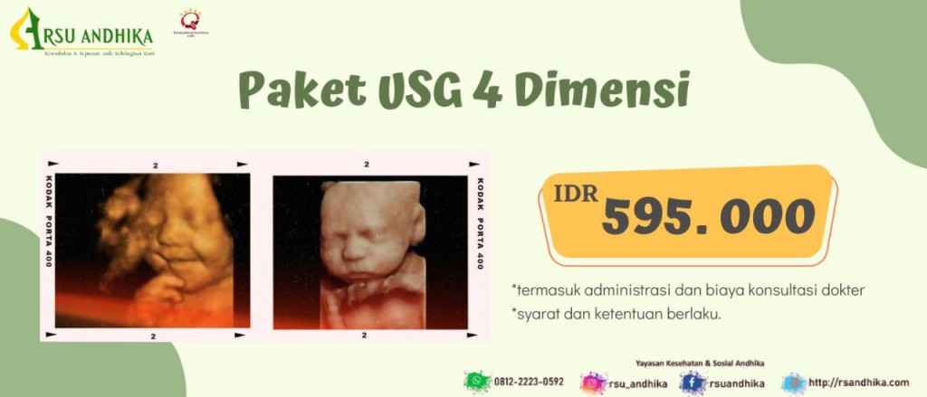 Paket USG 4 Dimensi